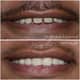 Slider image (9) Dr. Bharat Katarmal Dental and Implant Clinic